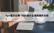 hpv是什么病（hpv是什么病毒图片女性）