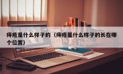 痔疮是什么样子的（痔疮是什么样子的长在哪个位置）