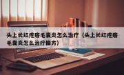 头上长红疙瘩毛囊炎怎么治疗（头上长红疙瘩毛囊炎怎么治疗偏方）