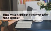 淋巴结肿大怎么消除颈部（右侧脖子淋巴结肿大怎么消除颈部）